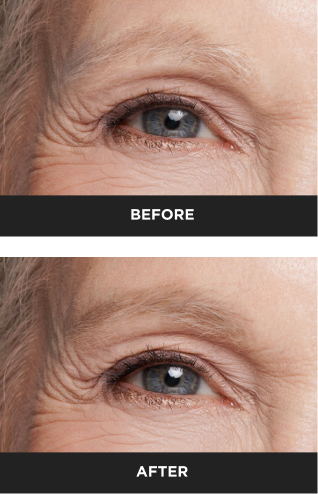 light eyebrows