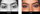 close set eyes before and after