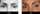 deep set eyes before and after