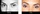 upturned eyes before and after
